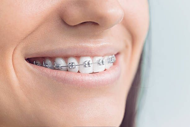Best Veneers and Lumineers  in La Grulla, TX